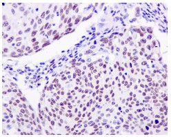 Immunohistochemistry (Formalin/PFA-fixed paraffin-embedded sections) - Anti-SSBP2 antibody [EPR11520] (AB177944)