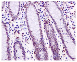 Immunohistochemistry (Formalin/PFA-fixed paraffin-embedded sections) - Anti-SSBP2 antibody [EPR11520] - BSA and Azide free (AB250016)