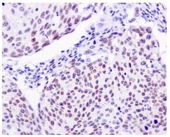 Immunohistochemistry (Formalin/PFA-fixed paraffin-embedded sections) - Anti-SSBP2 antibody [EPR11520] - BSA and Azide free (AB250016)