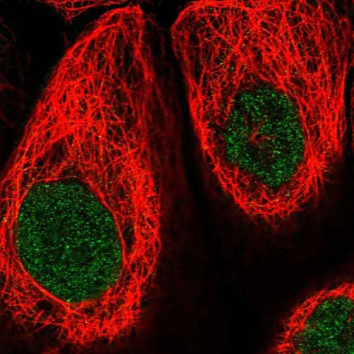 Immunocytochemistry/ Immunofluorescence - Anti-SSC5D antibody (AB122768)