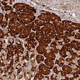 Immunohistochemistry (Formalin/PFA-fixed paraffin-embedded sections) - Anti-SSC5D antibody (AB122768)