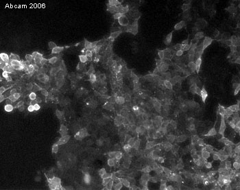 Immunocytochemistry - Anti-SSEA1 antibody [MC-480] (AB16285), expandable thumbnail