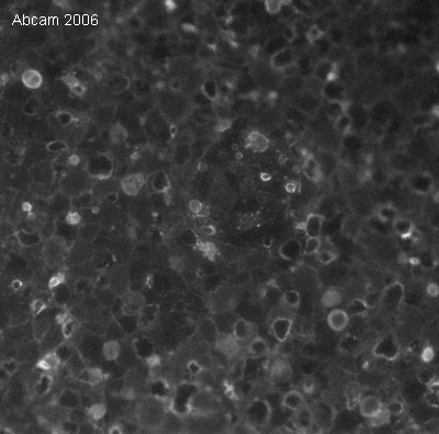 Immunocytochemistry/ Immunofluorescence - Anti-SSEA3 antibody [MC631] (AB16286), expandable thumbnail
