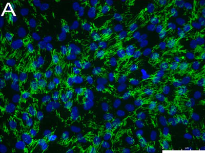 Immunocytochemistry/ Immunofluorescence - Anti-SSEA4 antibody [MC813-70] (AB16287)