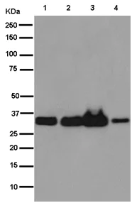Western blot - Anti-SSPN antibody [EPR15515] - BSA and Azide free (AB250890)
