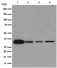 Western blot - Anti-SSPN antibody [EPR15515] - BSA and Azide free (AB250890)
