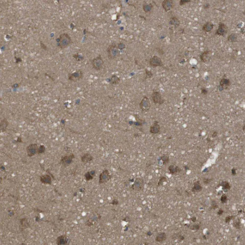 Immunohistochemistry (Formalin/PFA-fixed paraffin-embedded sections) - Anti-SSR3 antibody (AB121458)