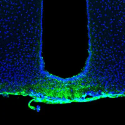 Immunohistochemistry (Formalin/PFA-fixed paraffin-embedded sections) - Anti-SSR3 antibody (AB121458)