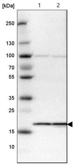 Western blot - Anti-SSR3 antibody (AB121458)