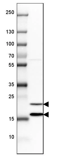 Western blot - Anti-SSR3 antibody (AB121458)