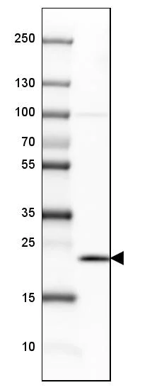 Western blot - Anti-SSR3 antibody (AB121458)