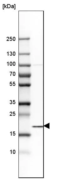Western blot - Anti-SSR3 antibody (AB121458)