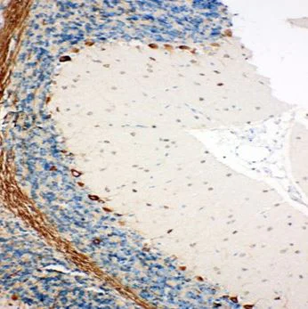 Immunohistochemistry (Formalin/PFA-fixed paraffin-embedded sections) - Anti-SSR3 antibody - N-terminal (AB190936)