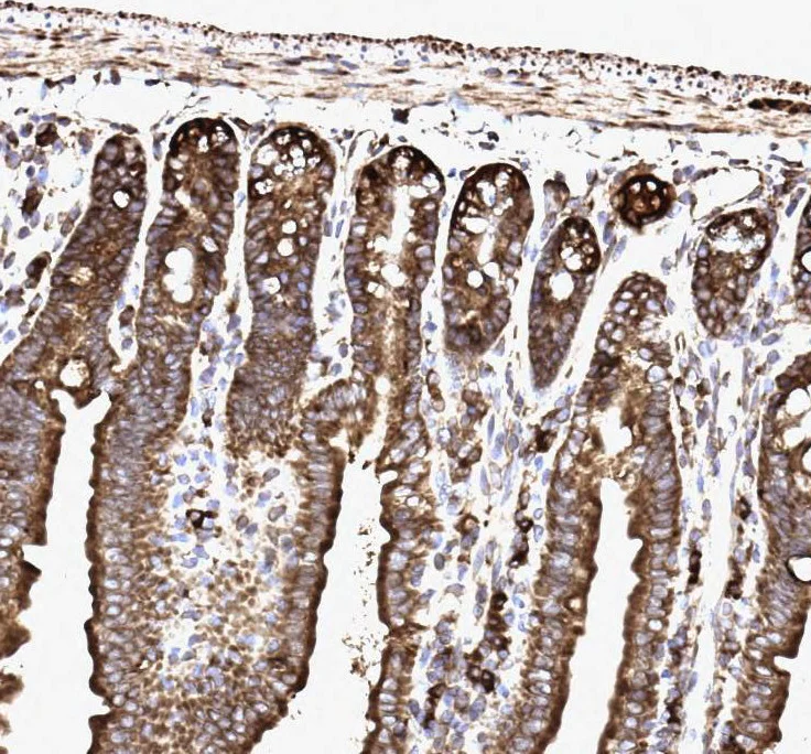 Immunohistochemistry (Formalin/PFA-fixed paraffin-embedded sections) - Anti-SSR3 antibody - N-terminal (AB190936)