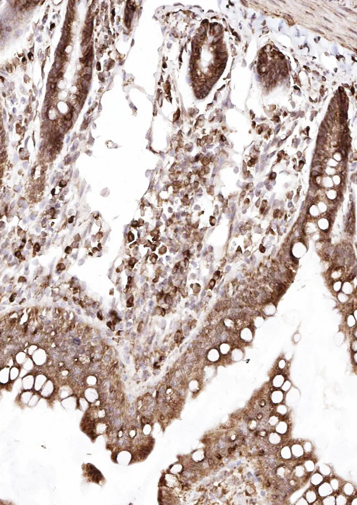 Immunohistochemistry (Formalin/PFA-fixed paraffin-embedded sections) - Anti-SSR3 antibody - N-terminal (AB190936)