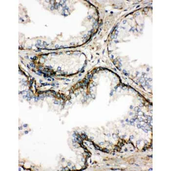 Immunohistochemistry (Formalin/PFA-fixed paraffin-embedded sections) - Anti-SSR3 antibody - N-terminal (AB190936)