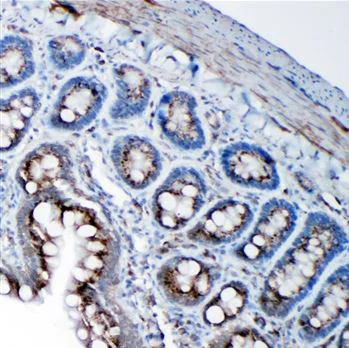 Immunohistochemistry (Formalin/PFA-fixed paraffin-embedded sections) - Anti-SSR3 antibody - N-terminal (AB190936)
