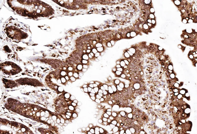 Immunohistochemistry (Formalin/PFA-fixed paraffin-embedded sections) - Anti-SSR3 antibody - N-terminal (AB190936)