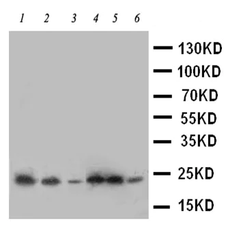 Western blot - Anti-SSR3 antibody - N-terminal (AB190936)