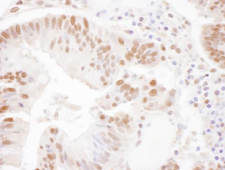 Immunohistochemistry (Formalin/PFA-fixed paraffin-embedded sections) - Anti-SSRP1 antibody (AB245560)