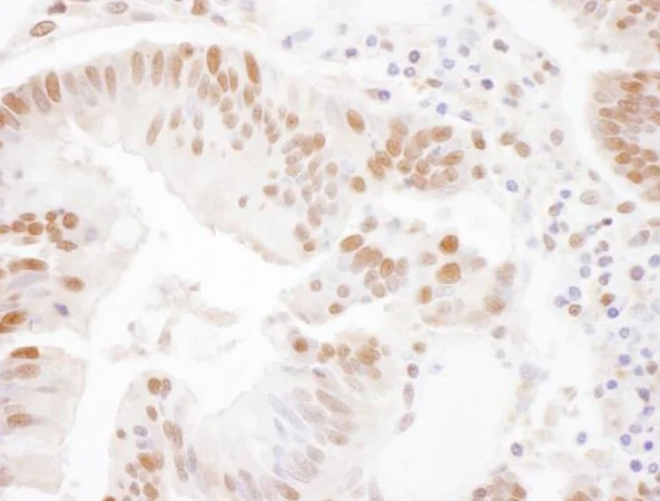 Immunohistochemistry (Formalin/PFA-fixed paraffin-embedded sections) - Anti-SSRP1 antibody (AB245560)