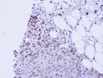 Immunohistochemistry (Formalin/PFA-fixed paraffin-embedded sections) - Anti-SSRP1 antibody (AB96704)