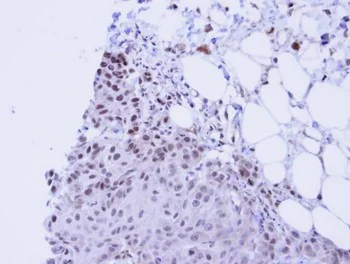 Immunohistochemistry (Formalin/PFA-fixed paraffin-embedded sections) - Anti-SSRP1 antibody (AB96704)