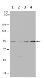 Western blot - Anti-SSRP1 antibody (AB96704)