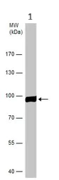 Western blot - Anti-SSRP1 antibody (AB96704)