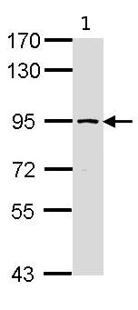 Western blot - Anti-SSRP1 antibody (AB96704)