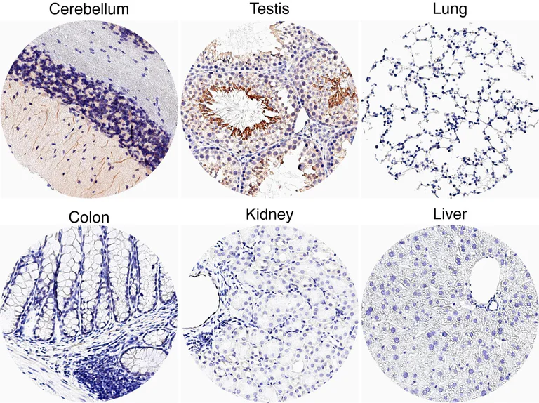 Immunohistochemistry (Formalin/PFA-fixed paraffin-embedded sections) - Anti-SSTR3 antibody [HL2681] - BSA and Azide free (AB325874)