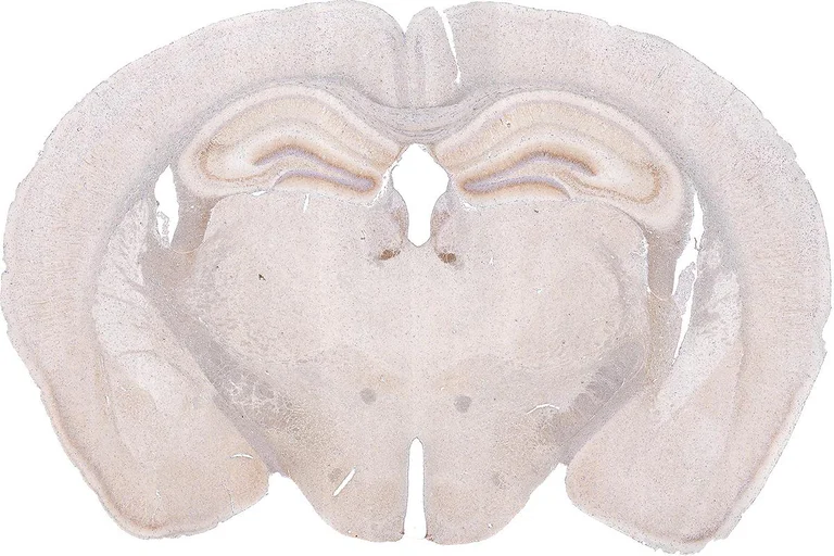 Immunohistochemistry (Formalin/PFA-fixed paraffin-embedded sections) - Anti-SSTR3 antibody [HL2681] - BSA and Azide free (AB325874)