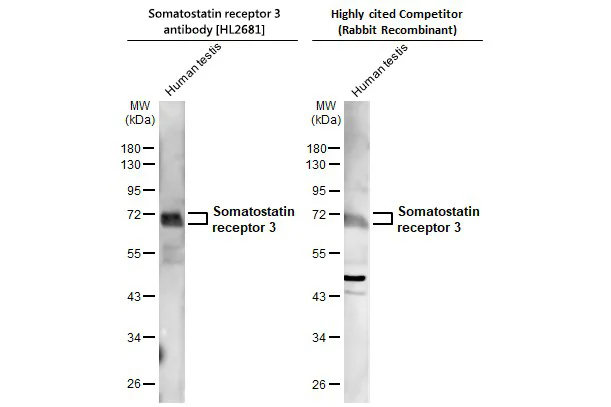 Western blot - Anti-SSTR3 antibody [HL2681] - BSA and Azide free (AB325874)
