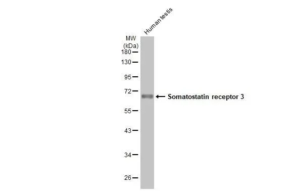 Western blot - Anti-SSTR3 antibody [HL2681] - BSA and Azide free (AB325874)