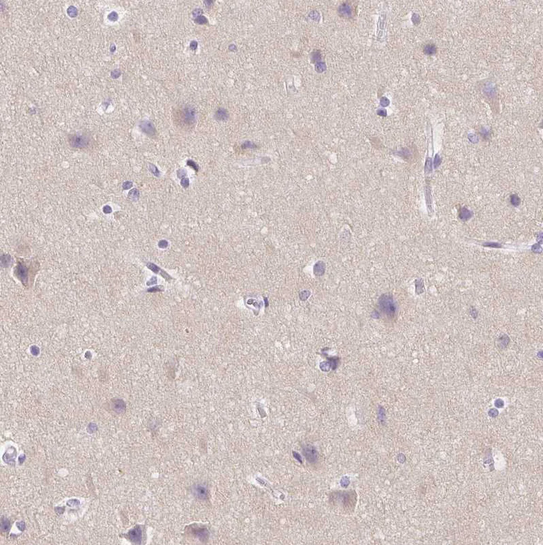 Immunohistochemistry (Formalin/PFA-fixed paraffin-embedded sections) - Anti-SSTR4 antibody (AB272677)