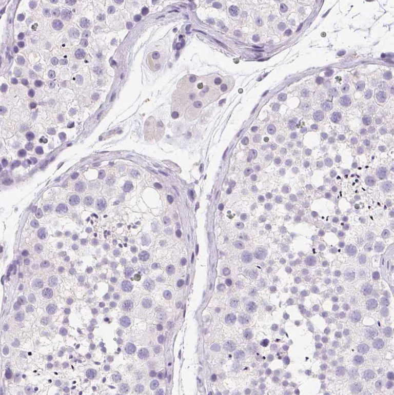 Immunohistochemistry (Formalin/PFA-fixed paraffin-embedded sections) - Anti-SSTR4 antibody (AB272677)