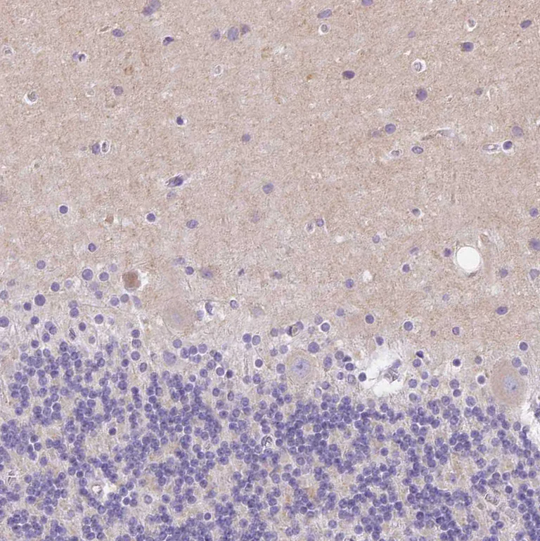 Immunohistochemistry (Formalin/PFA-fixed paraffin-embedded sections) - Anti-SSTR4 antibody (AB272677)