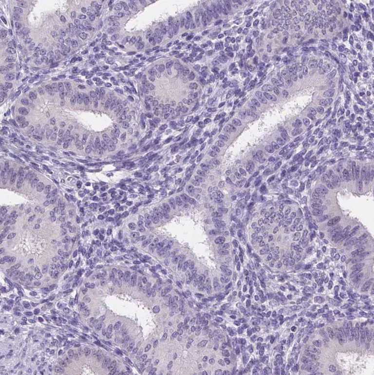 Immunohistochemistry (Formalin/PFA-fixed paraffin-embedded sections) - Anti-SSTR4 antibody (AB272677)