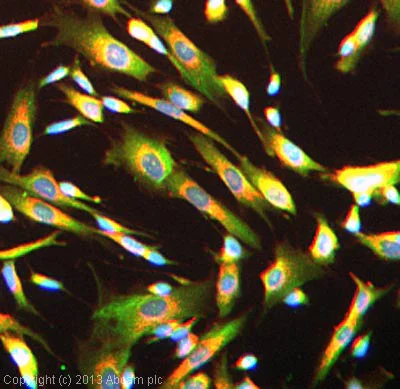 Immunocytochemistry/ Immunofluorescence - Anti-SSTR4 antibody (AB28578)