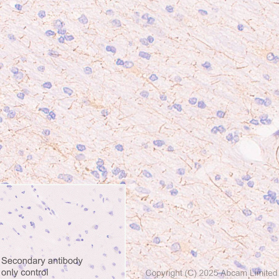 Immunohistochemistry (Formalin/PFA-fixed paraffin-embedded sections) - Anti-SSTR4 antibody [EPR29682-48] (ab324103), expandable thumbnail
