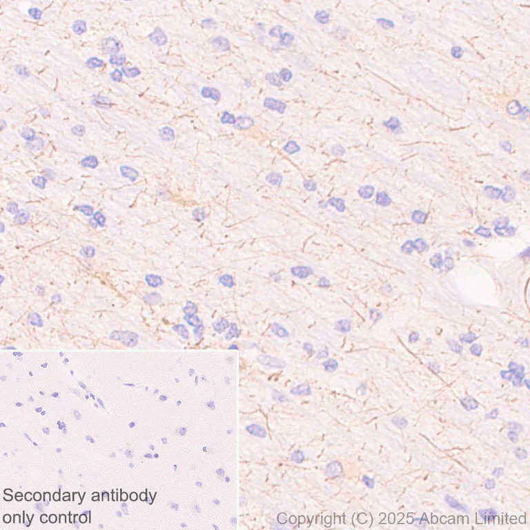 Immunohistochemistry (Formalin/PFA-fixed paraffin-embedded sections) - Anti-SSTR4 antibody [EPR29682-48] (AB324103)