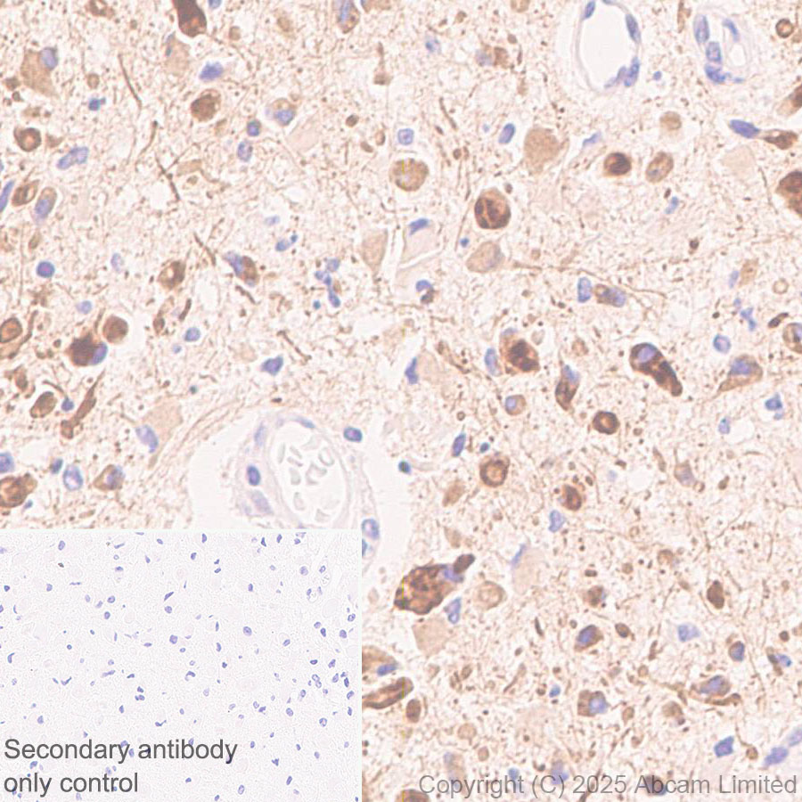 Immunohistochemistry (Formalin/PFA-fixed paraffin-embedded sections) - Anti-SSTR4 antibody [EPR29682-48] (AB324103), expandable thumbnail