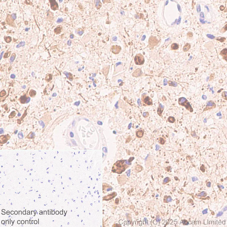 Immunohistochemistry (Formalin/PFA-fixed paraffin-embedded sections) - Anti-SSTR4 antibody [EPR29682-48] (AB324103)