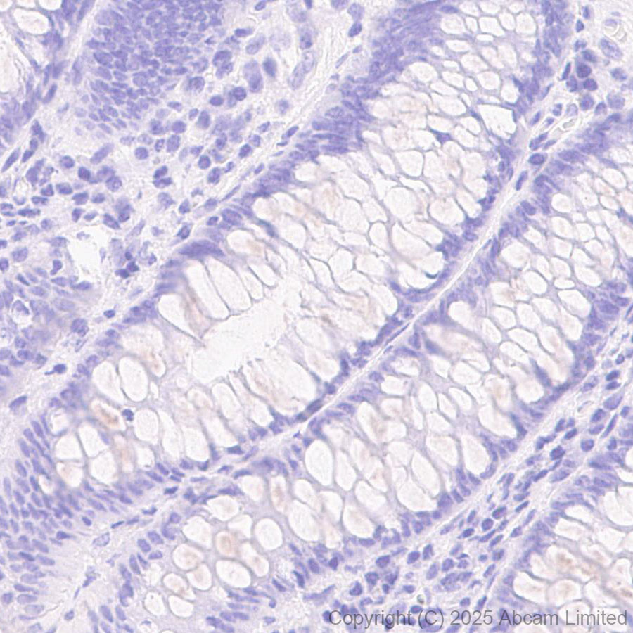 Immunohistochemistry (Formalin/PFA-fixed paraffin-embedded sections) - Anti-SSTR4 antibody [EPR29682-48] (AB324103), expandable thumbnail