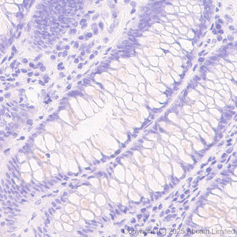 Immunohistochemistry (Formalin/PFA-fixed paraffin-embedded sections) - Anti-SSTR4 antibody [EPR29682-48] (AB324103)