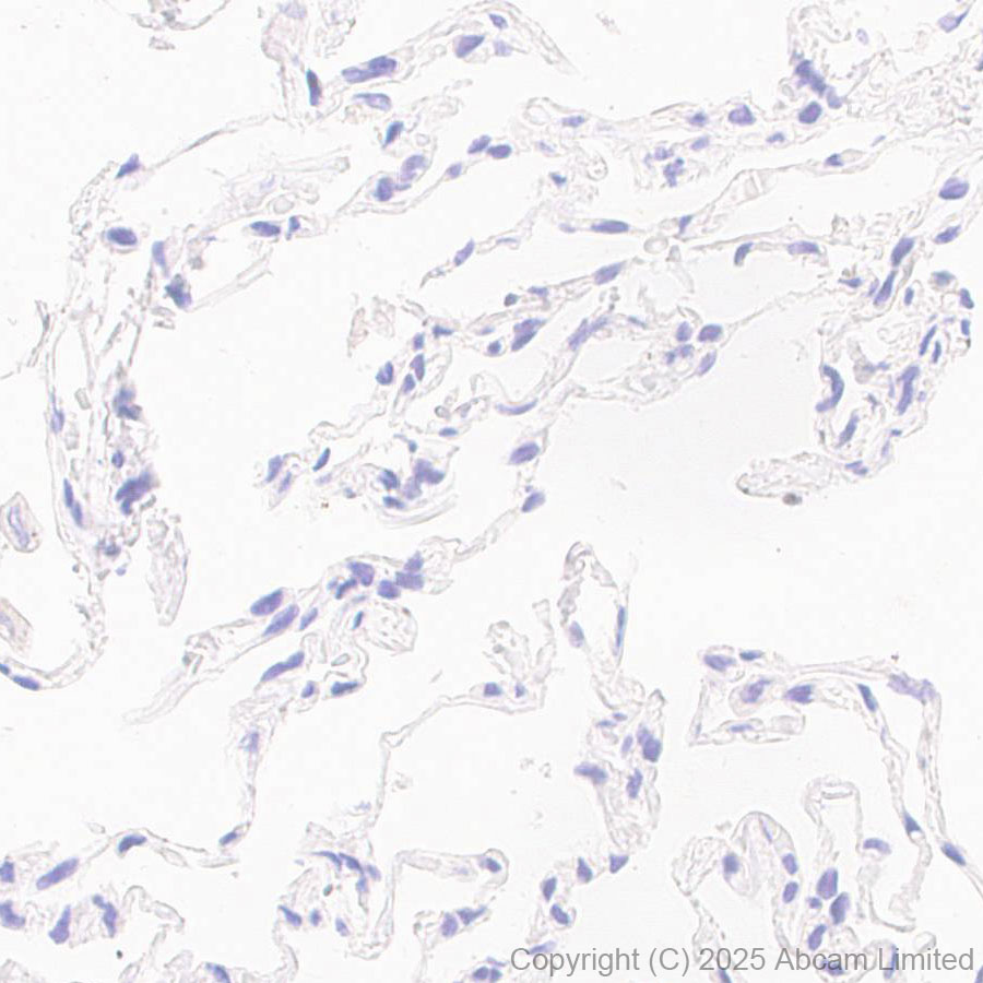 Immunohistochemistry (Formalin/PFA-fixed paraffin-embedded sections) - Anti-SSTR4 antibody [EPR29682-48] (AB324103), expandable thumbnail