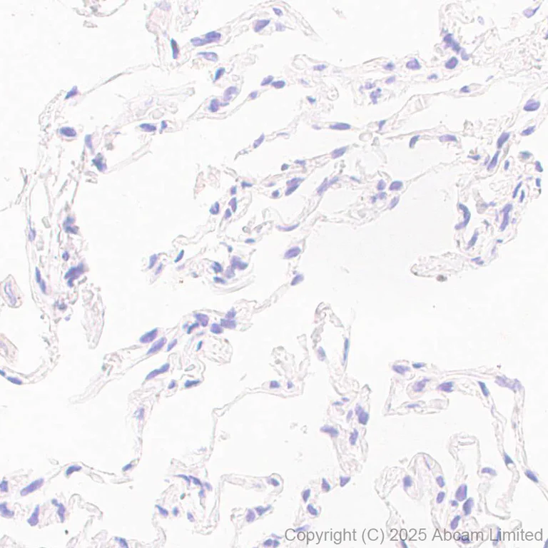Immunohistochemistry (Formalin/PFA-fixed paraffin-embedded sections) - Anti-SSTR4 antibody [EPR29682-48] (AB324103)