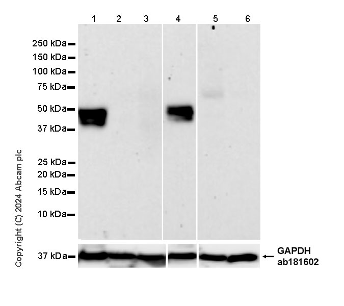Western blot - Anti-SSTR4 antibody [EPR29682-48] (AB324103), expandable thumbnail