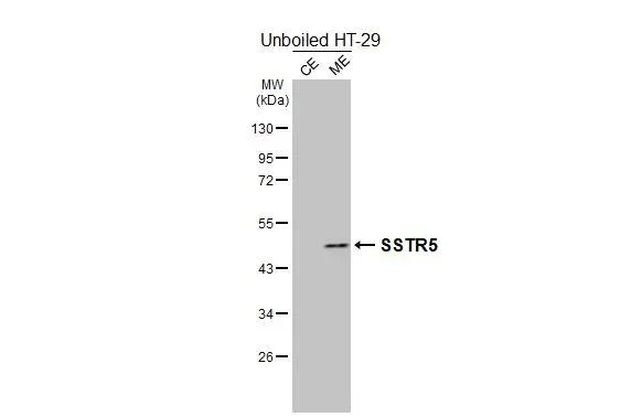 Western blot - Anti-SSTR5 antibody [HL2756] - BSA and Azide free (AB325875)