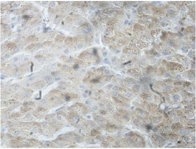 Immunohistochemistry (Formalin/PFA-fixed paraffin-embedded sections) - Anti-Ssu72 antibody (AB207849)